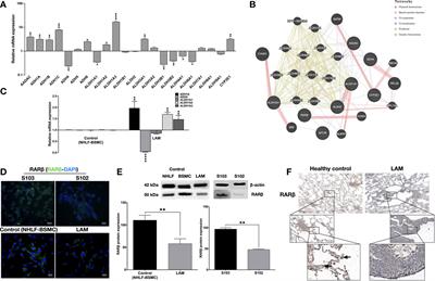 Normalization of Enzyme Expression and Activity Regulating Vitamin A Metabolism Increases RAR-Beta Expression and Reduces Cellular Migration and Proliferation in Diseases Caused by Tuberous Sclerosis Gene Mutations